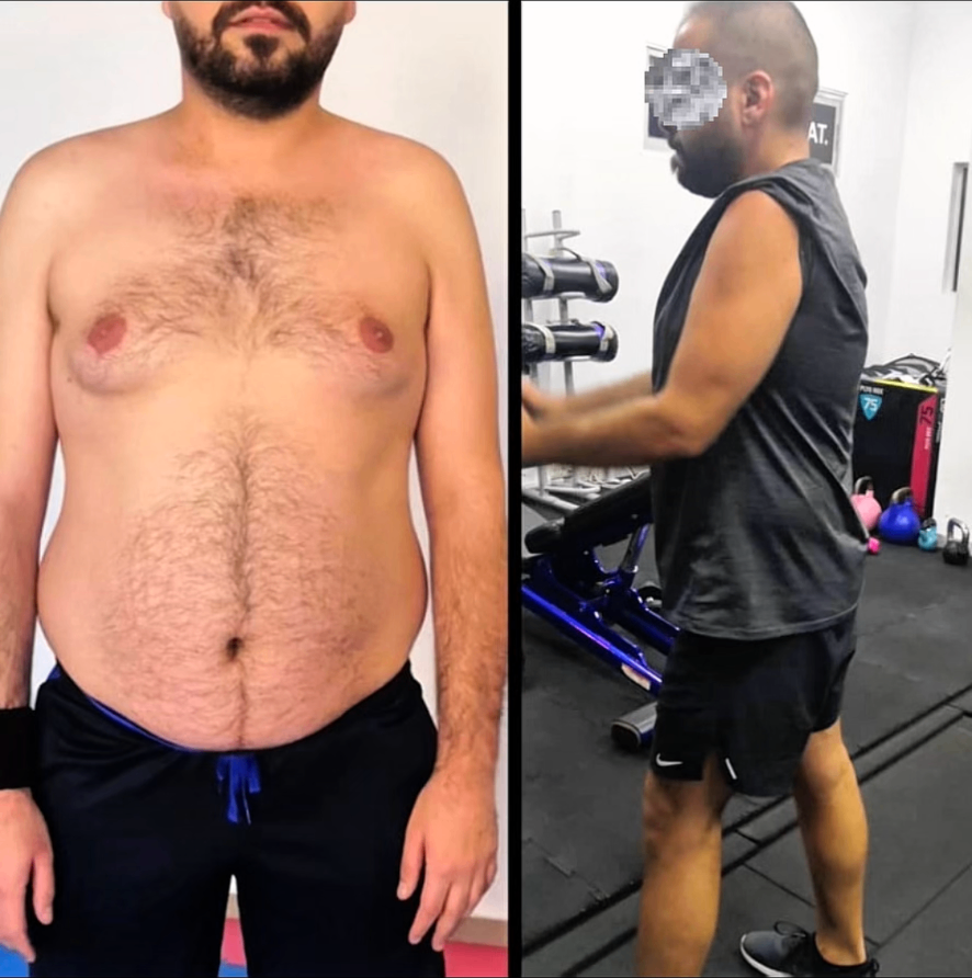 Nour, 31 — before and after transformation